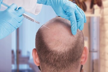 What Are the Risks and Side Effects of Hair Transplant Surgery?