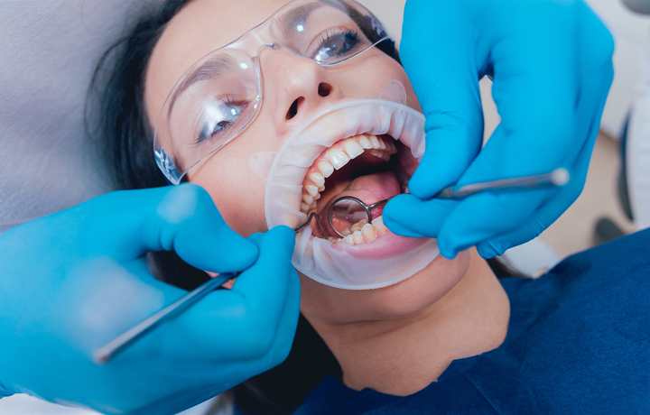 How AI-Powered Risk Prediction Models Are Changing Dental Check