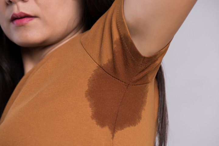 Hyperhidrosis Treatment in Delhi for Excessive Sweating
