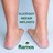 Treatment For Flat Feet  Woodbridge